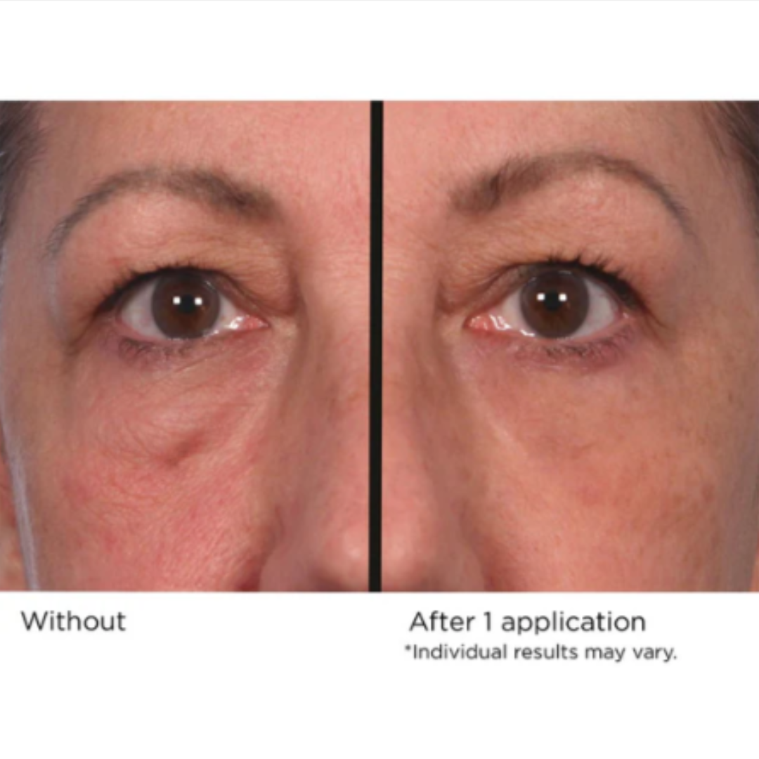 Quickfix Wrinkle Reducing Serum, Fine linjer, Rynker