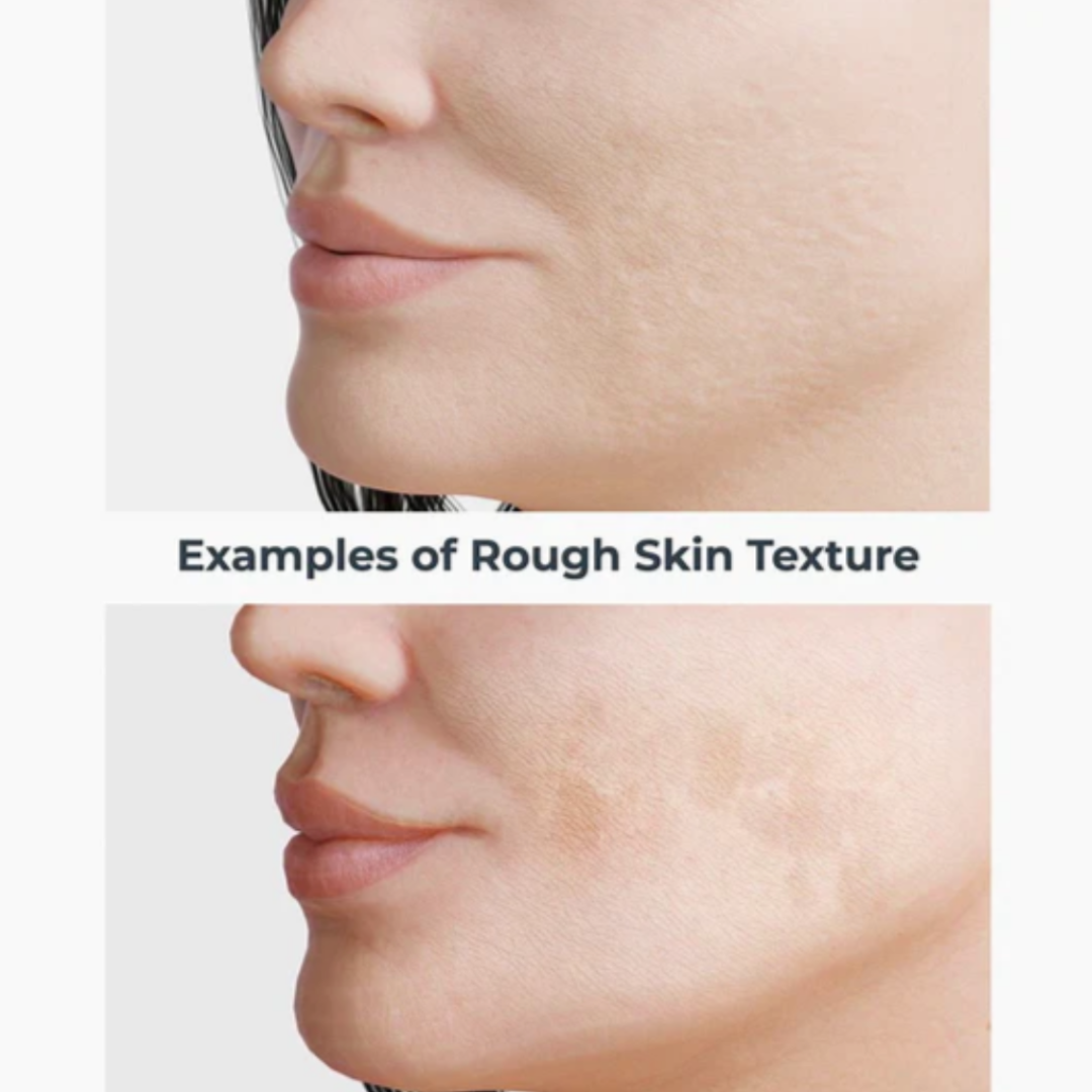 Even, Correct & Renew Pads